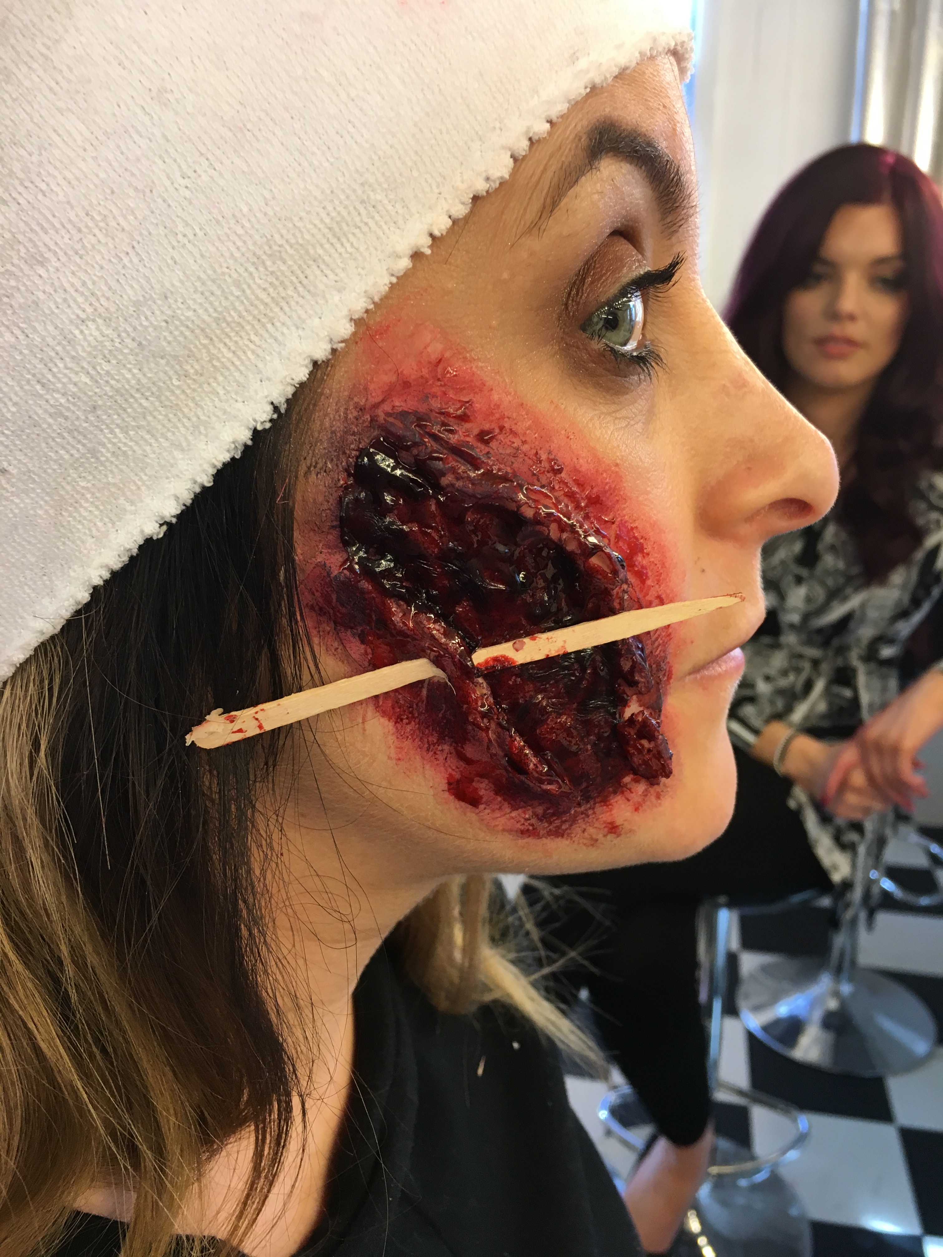 Open slash wound