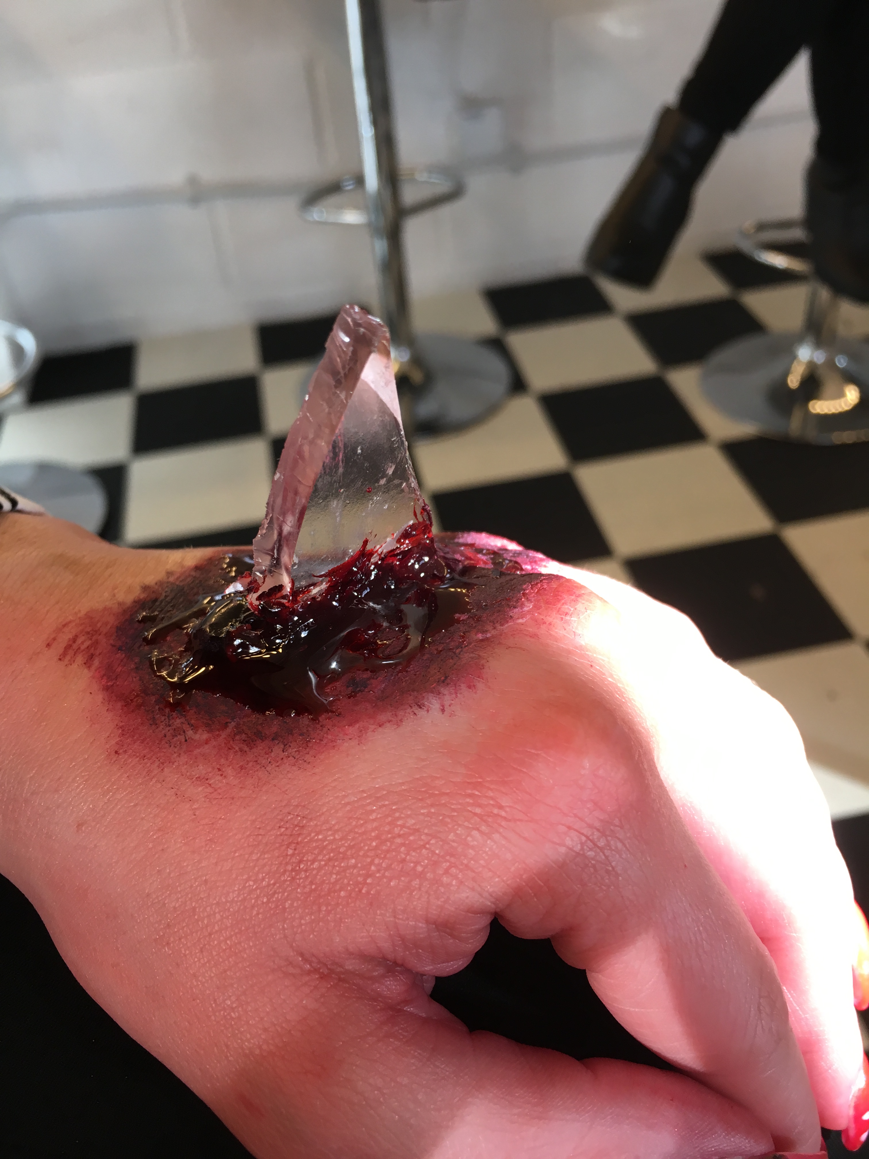 Broken glass embedded in bloodied hand