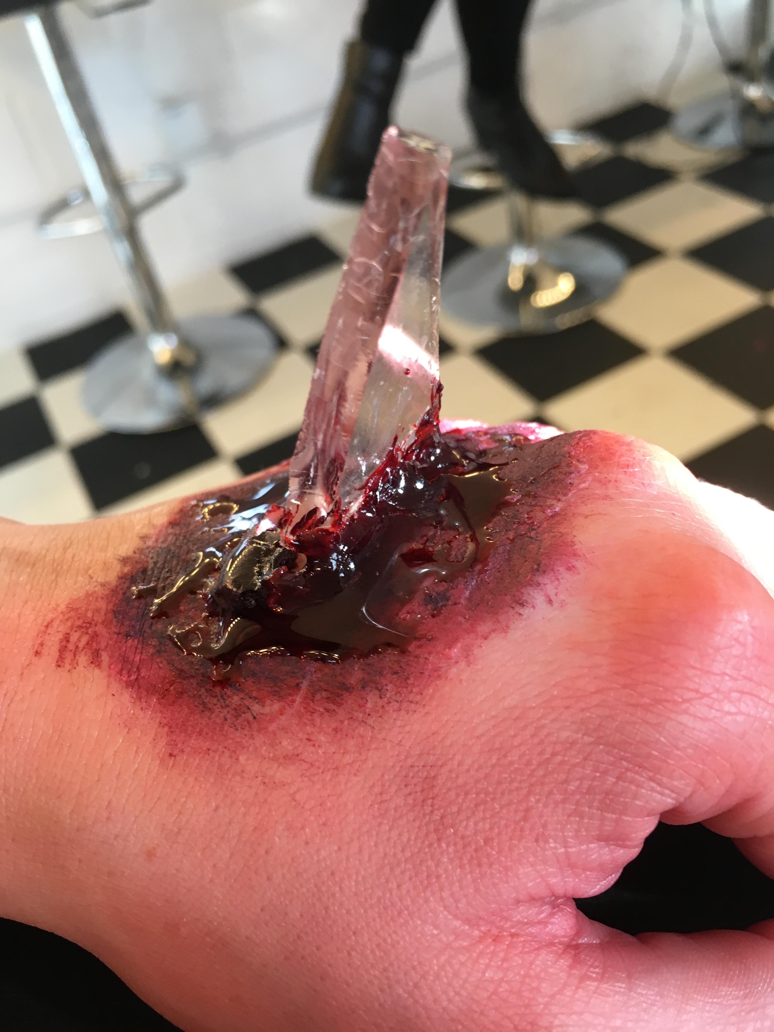 Broken glass embedded in bloodied hand
