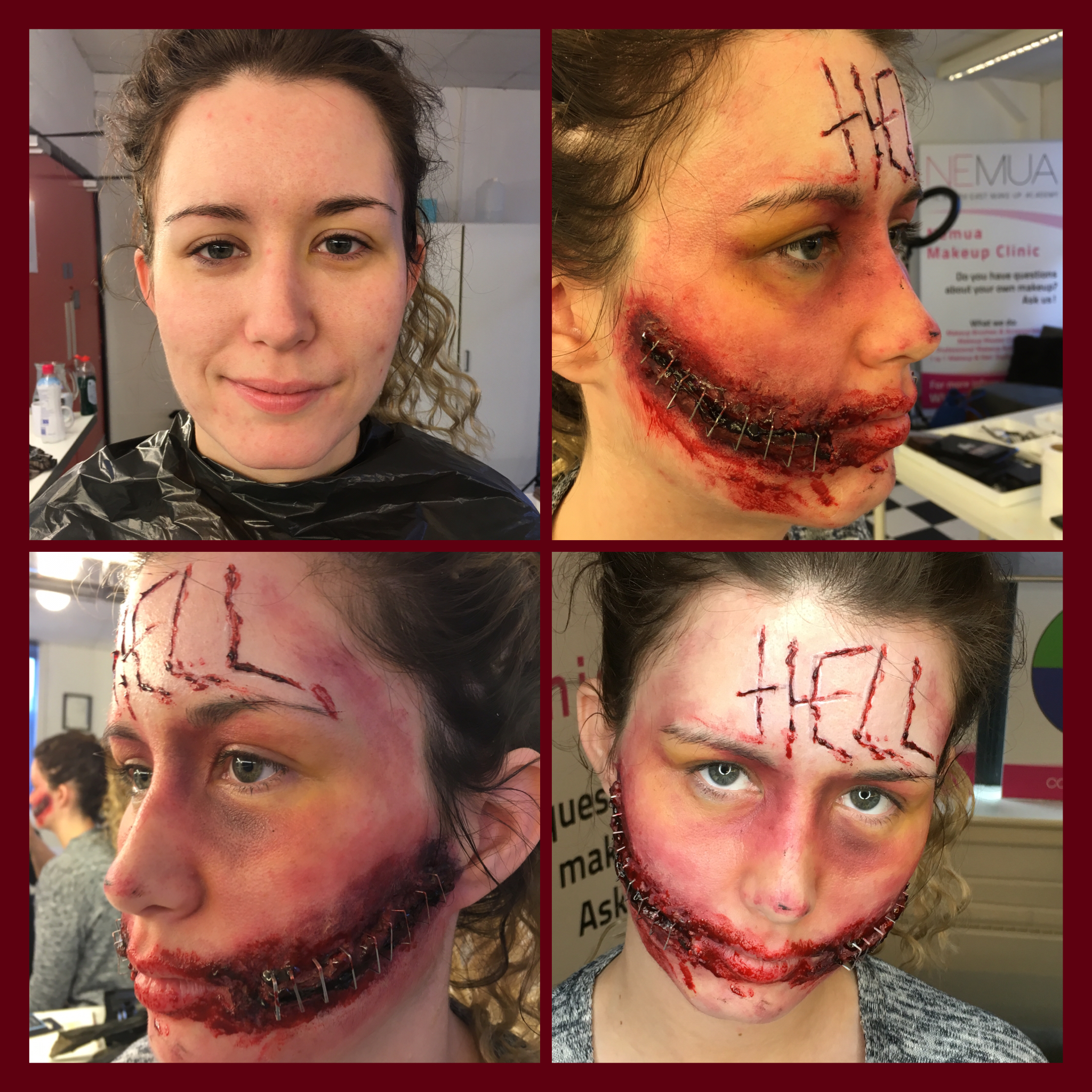Gory Chelsea Smile with skin carving