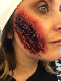 Open slash wound