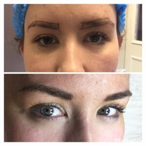 Before and after photo of microblading results on client done in my home studio in Guisborough