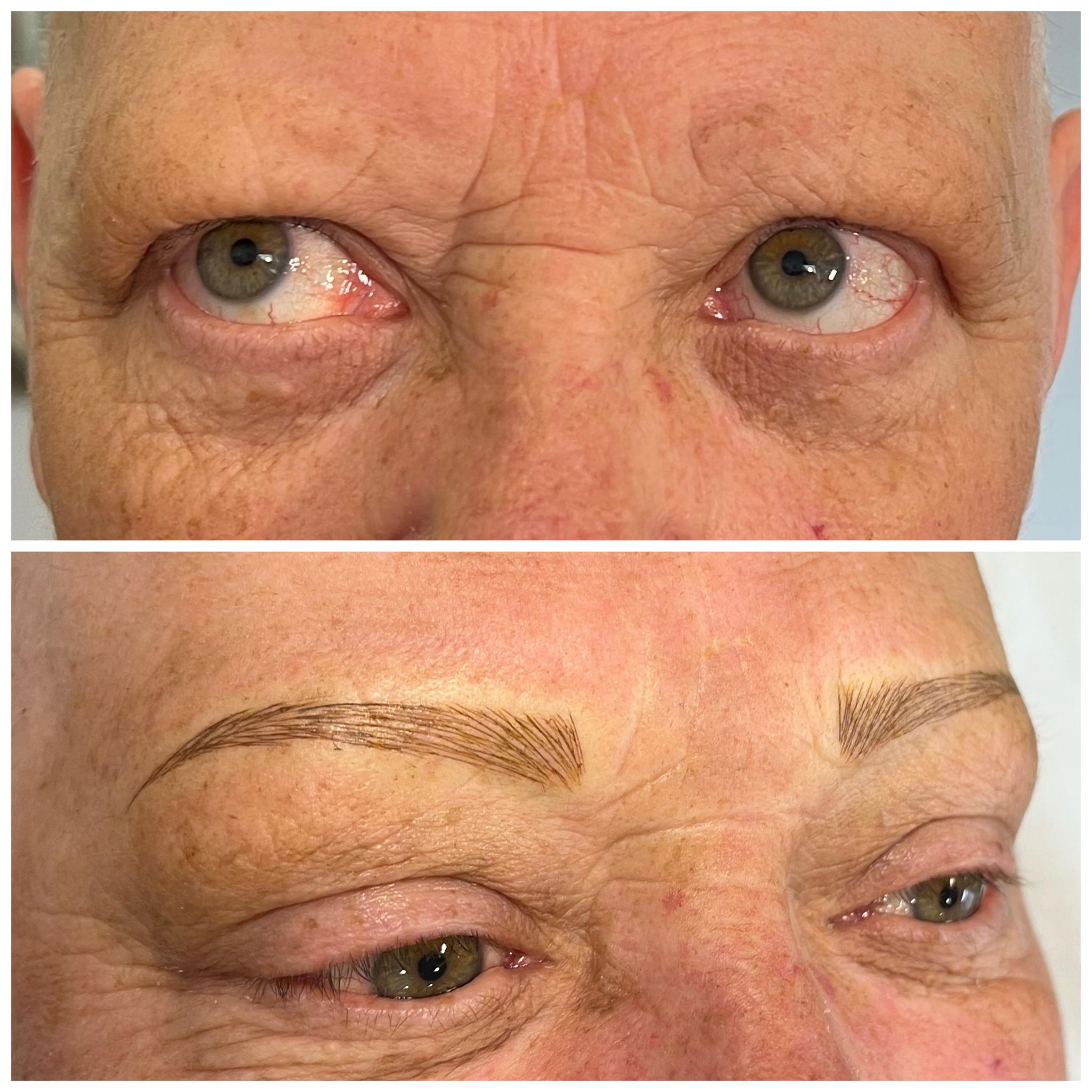 alopecia client with micro bladed eyebrows